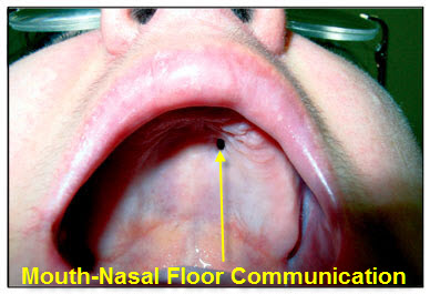Oral Biopsies – Operative Warnings11